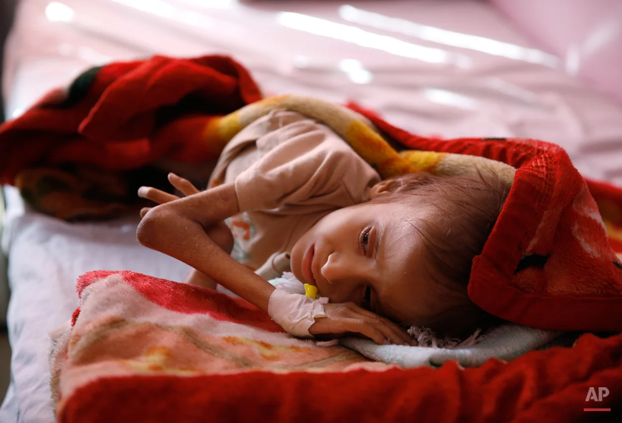 APTOPIX Mideast War And Hunger