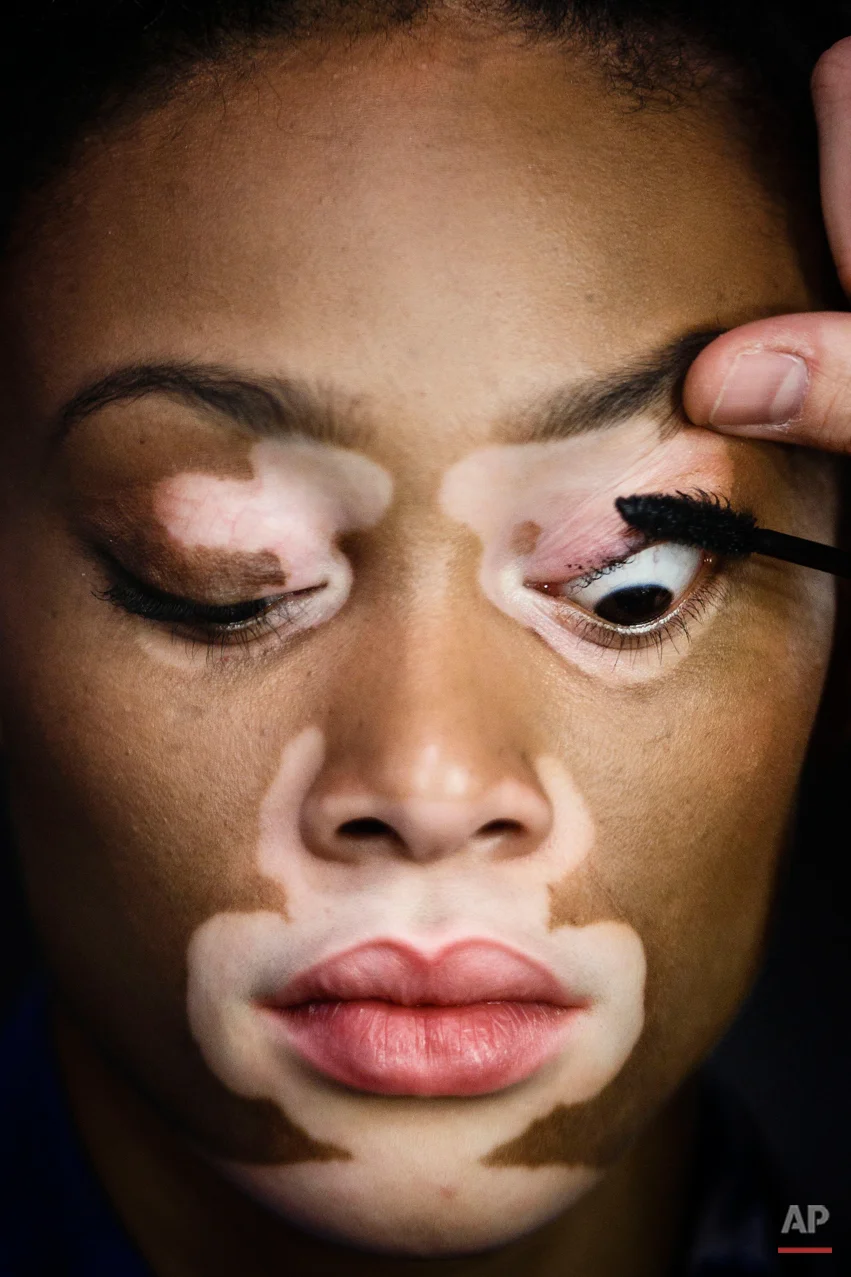 In this photo taken on Friday, Feb. 6, 2015, top model Chantelle Brown-Young, known as Winnie Harlow, gets her make up applied before displaying a Spring/Summer design by Desigual at Madrid's Fashion Week in Madrid, Spain. Madrid Fashion Week has celebrated its 30th anniversary with presentations from 44 designers and brands by models on catwalks in Spain's premier fashion showcase. (AP Photo/Daniel Ochoa de Olza)