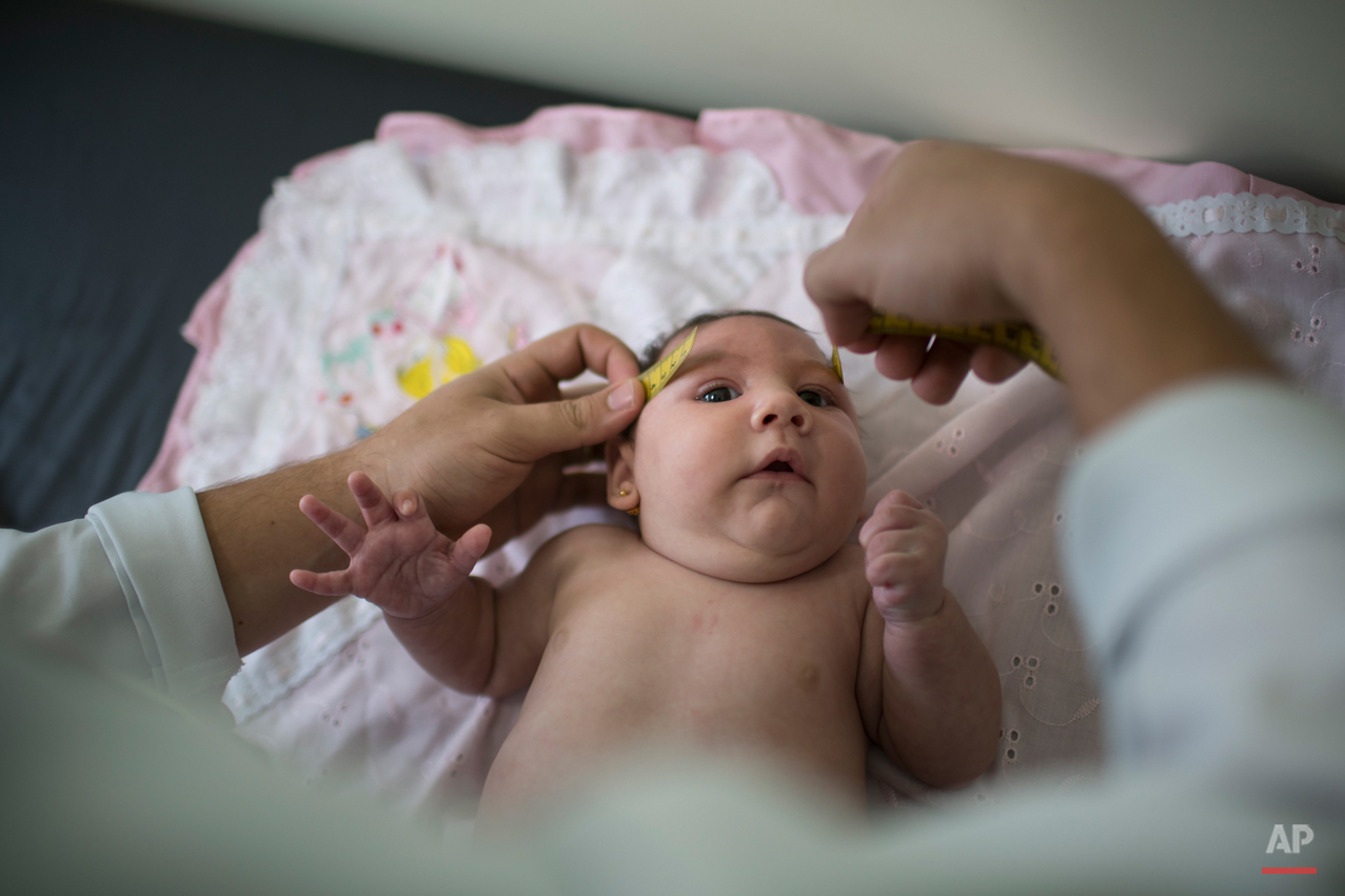  In this Dec. 22, 2015 photo, Luiza has her head measured by a neurologist at the Mestre Vitalino Hospital in Caruaru, Pernambuco state, Brazil. Luiza was born in October with a head that was just 11.4 inches (29 centimeters) in diameter, more than a