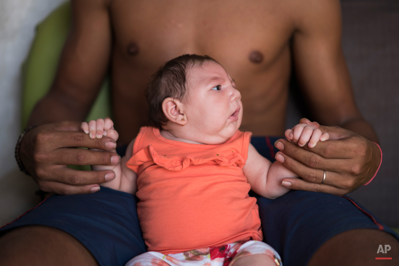  In this Dec. 23, 2015 photo, Dejailson Arruda holds his daughter Luiza at their house in Santa Cruz do Capibaribe, Pernambuco state, Brazil. Luiza was born in October with a rare condition, known as microcephaly. Luiza's mother Angelica Pereira was 