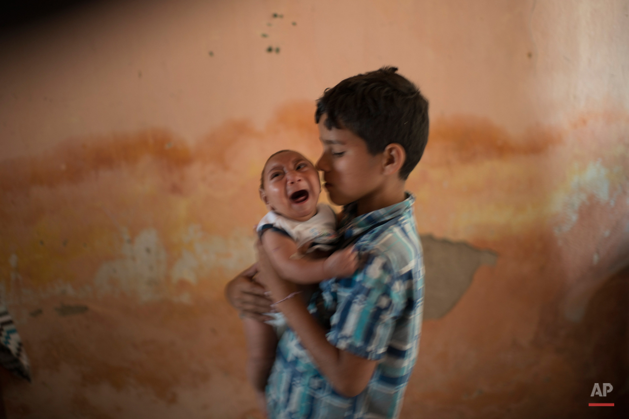  In this Dec. 23, 2015 photo, 10-year-old Elison nurses his 2-month-old brother Jose Wesley at their house in Poco Fundo, Pernambuco state, Brazil.  Suspicion of the link between microcephaly and the Zika virus arose after officials recorded 17 cases