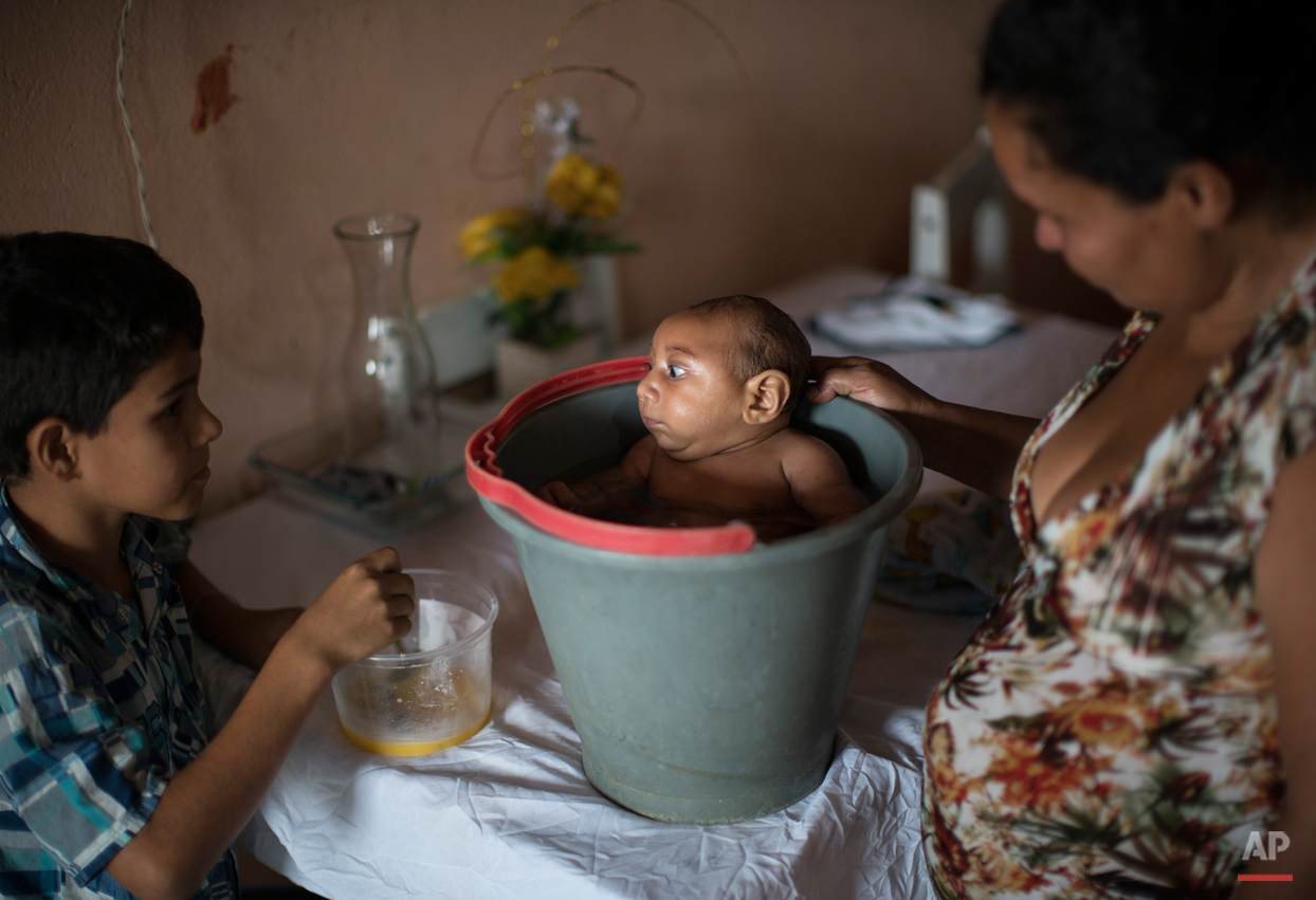  In this Dec. 23, 2015 photo, 10-year-old Elison, left, watches as his mother Solange Ferreira bathes Jose Wesley in a bucket at their house in Poco Fundo, Pernambuco state, Brazil. Ferreira says Jose Wesley enjoys being in the water, she places him 
