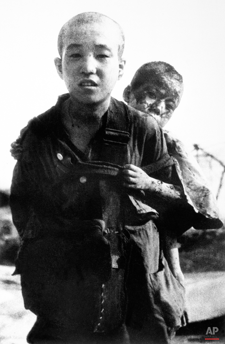 An unidentified young boy carries his burned brother on his back Aug. 10, 1945 in Nagasaki, Japan. This photographs was not released to the public by the Japanese military but was disseminated to the world press by the United Nations after the war. 