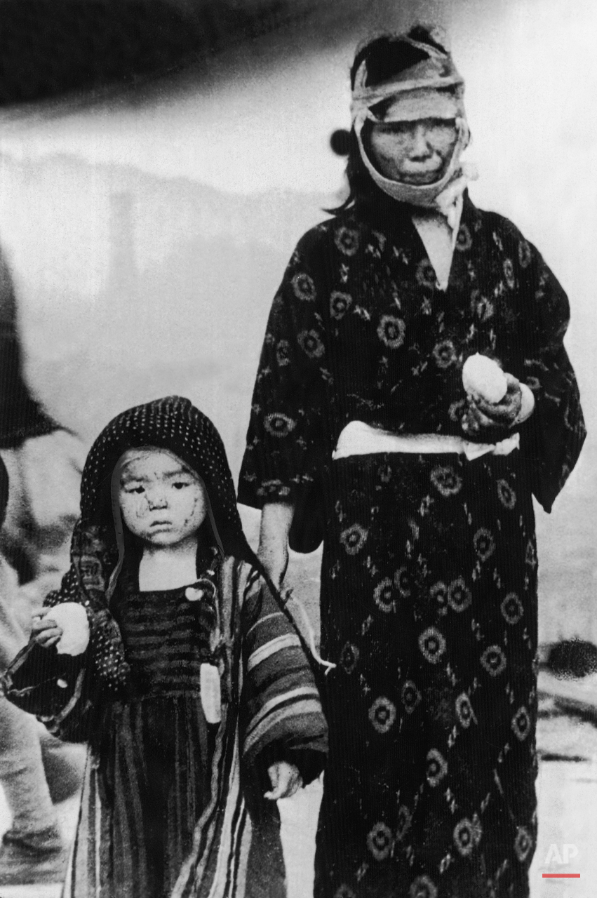  A Japanese woman is seen with a child in traditional Japanese clothing, who survived the atomic bomb dropped on Nagasaki, in Nagasaki, Japan, August 9, 1945. Their faces are marked with burns by the heat of the explosion. Scanty food rations are giv