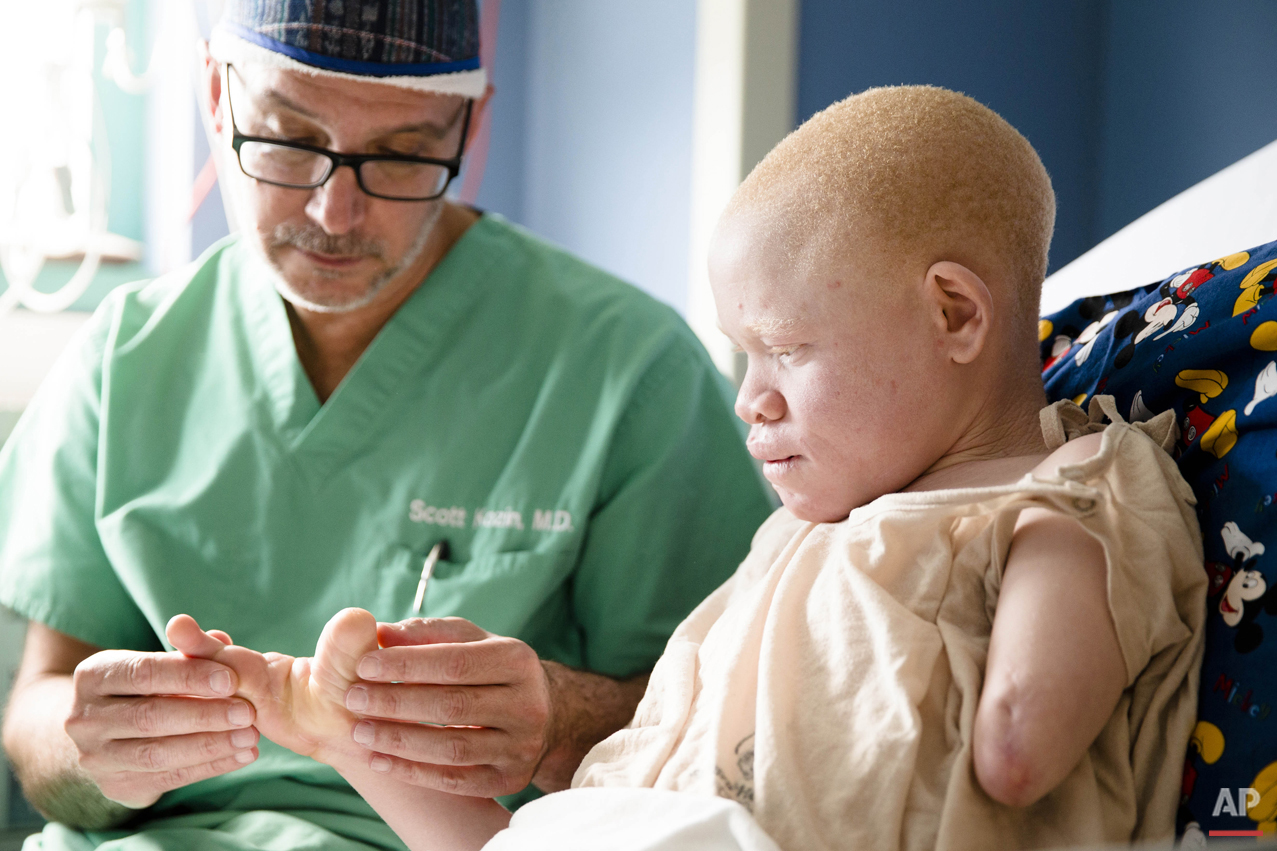 Albino Children: Receiving Prosthetics