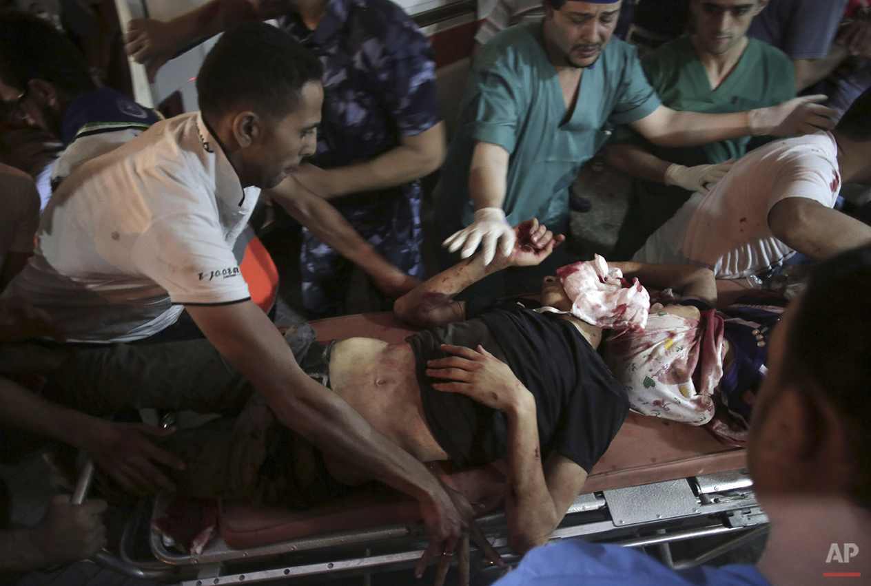  Medics wheel two wounded Palestinians into the emergency room of Shifa hospital in Gaza City, northern Gaza Strip, early Friday, July 18, 2014. The heavy thud of tank shells, often just seconds apart, echoed across the Gaza Strip early Friday as tho