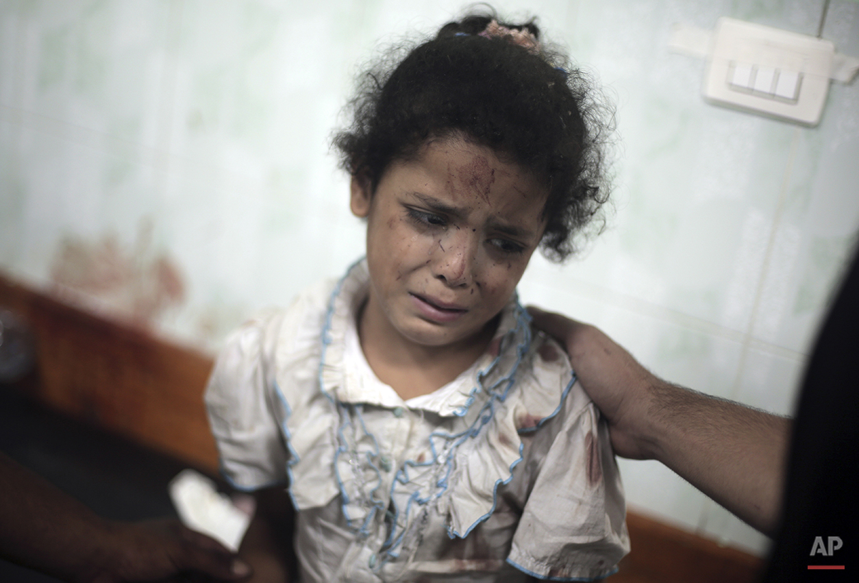  A Palestinian girl cries while receiving treatment for her injuries caused by an Israeli strike at a U.N. school in Jebaliya refugee camp, at the Kamal Adwan hospital in Beit Lahiya, northern Gaza Strip, Wednesday, July 30, 2014. Several Israeli tan