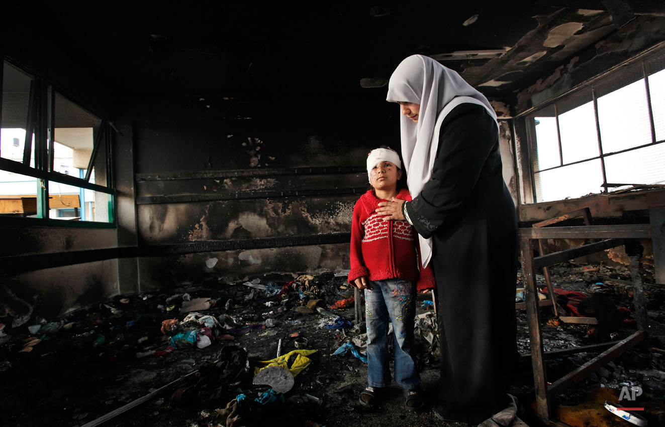  In this photo taken Monday, Jan. 19, 2009, Fatma Zidane El-Banneh, 8, and her mother Azza are pictured after returning from hospital to the Beit Lahiya Elementary Co-educational school, where Azhar said Fatma was burned by white phosphorus, which co