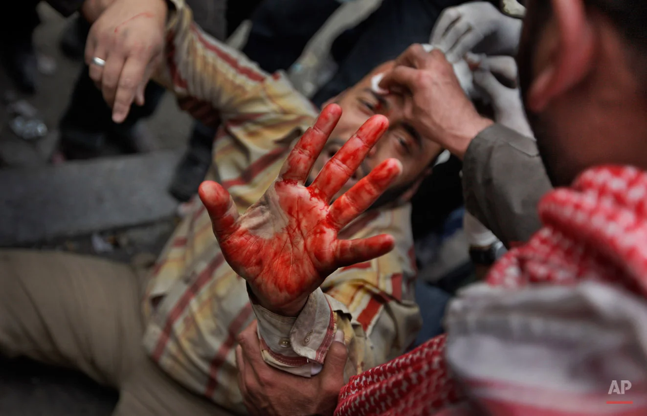 A wounded anti-government protester holds up his bloodied hand as he is carried by others back from clashes with pro-government supporters near the Egyptian Museum in downtown Cairo, Egypt, Thursday, Feb. 3, 2011. Anti-government protesters and regime supporters clashed in a second day of rock-throwing battles, while gangs of thugs supporting Egyptian President Hosni Mubarak attacked reporters, foreigners and rights workers as the army rounded up foreign journalists and new looting and arson were reported. (AP Photo/Ben Curtis)