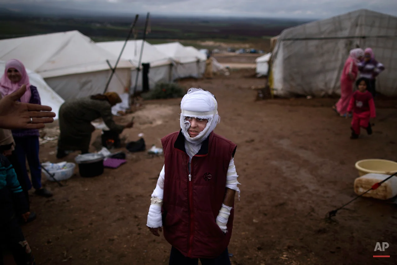 Abdullah Ahmed, 10, who suffered burns in a Syrian government airstrike and fled his home with his family, stands outside their tent at a camp for displaced Syrians in the village of Atmeh, Syria, Tuesday, Dec. 11, 2012. This tent camp sheltering some of the hundreds of thousands of Syrians uprooted by the country's brutal civil war has lost the race against winter: the ground under white tents is soaked in mud, rain water seeps into thin mattresses and volunteer doctors routinely run out of medicine for coughing, runny-nosed children. (AP Photo/Muhammed Muheisen)