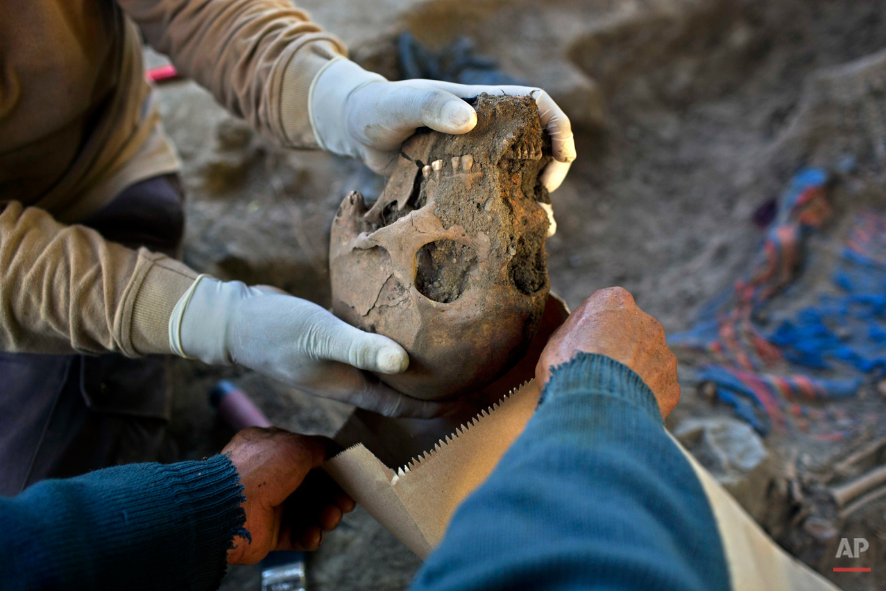  In this Sept. 7, 2014 photo, a forensic anthropologist places an unearthed skull in a bag during the exhumation of mass graves of villagers slain by security forces, in the Paccha village of Peru. In all, 21 sets of human remains were recovered, inc