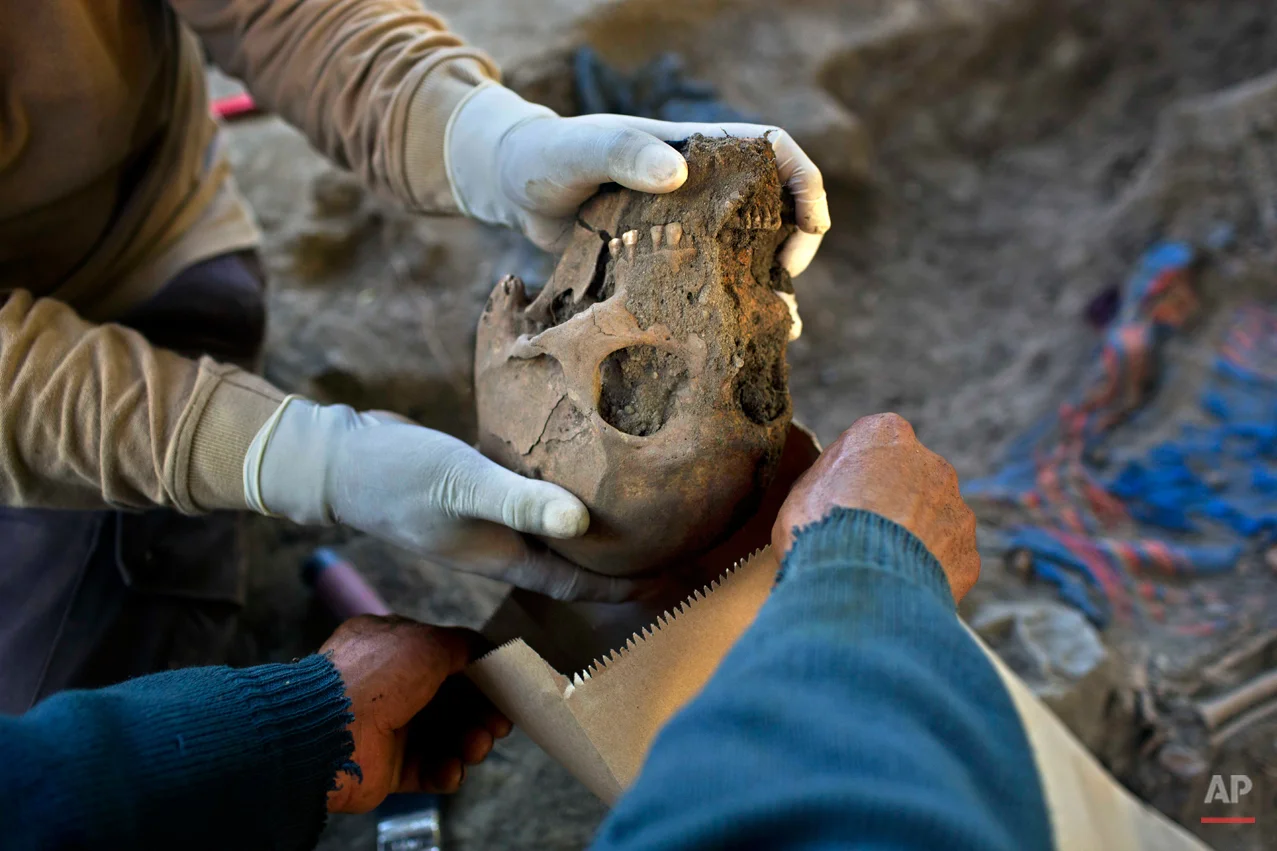 In this Sept. 7, 2014 photo, a forensic anthropologist places an unearthed skull in a bag during the exhumation of mass graves of villagers slain by security forces, in the Paccha village of Peru. In all, 21 sets of human remains were recovered, including those of eight children and a fetus, said Luis Rueda, the forensic archaeologist overseeing the dig. (AP Photo/Rodrigo Abd)