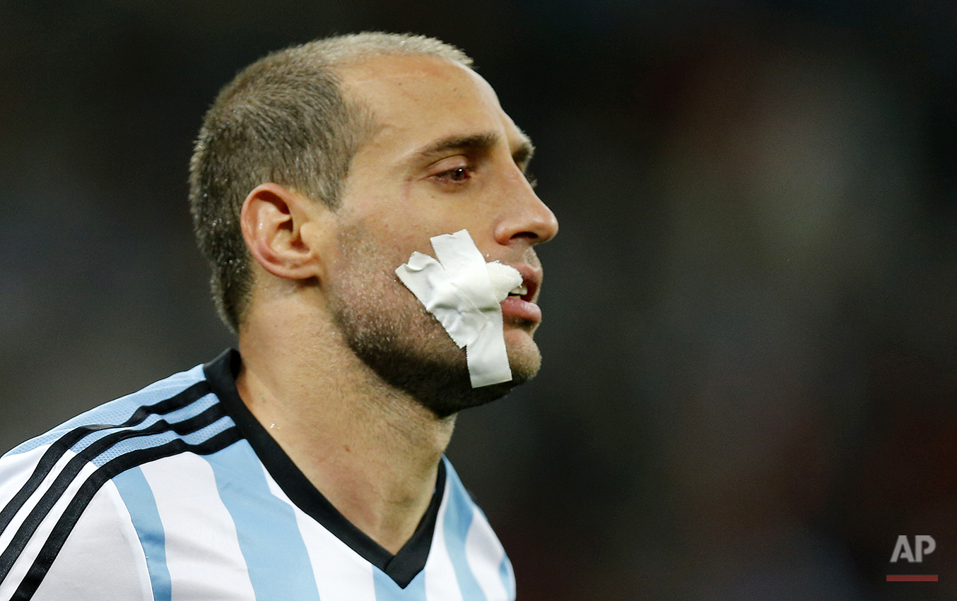  Argentina's Pablo Zabaleta has his face covered with gauze during the World Cup semifinal soccer match between the Netherlands and Argentina at the Itaquerao Stadium in Sao Paulo, Brazil, Wednesday, July 9, 2014. (AP Photo/Frank Augstein) 