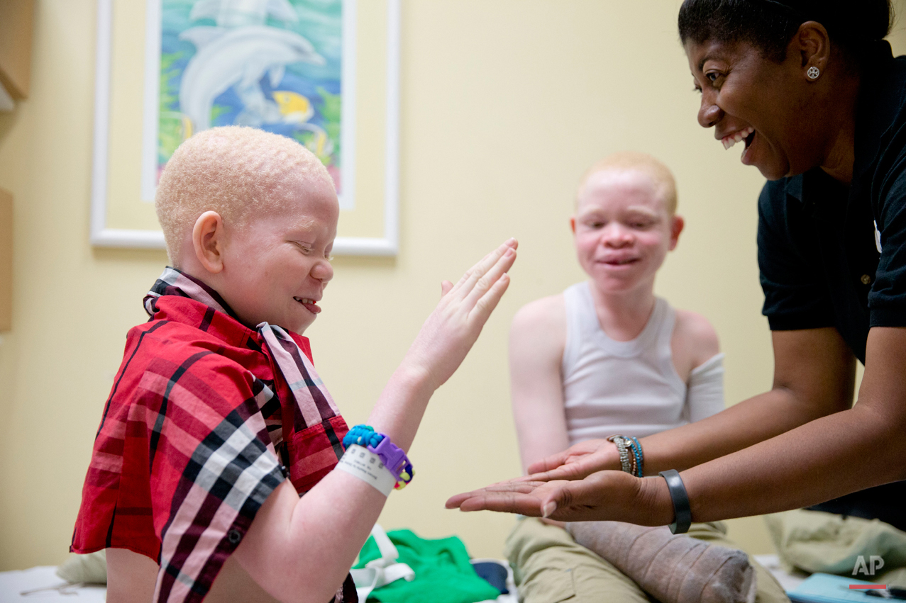  Monica Watson, right, with the Global Medical Relief Fund, plays with Mwigulu Magesa, 12, left, and Emmanuel Rutema, 13, during a fitting for prosthetic limbs at the Shriners Hospital for Children in Philadelphia on Thursday, July 23, 2015. Witch do