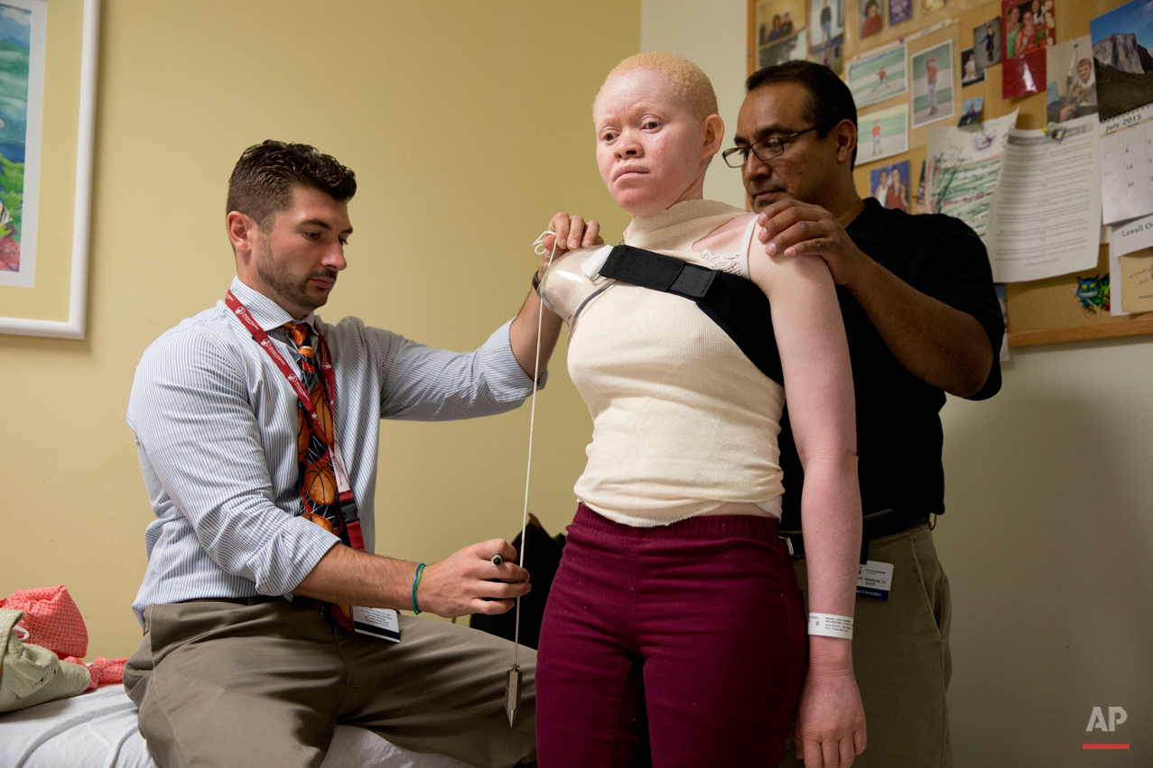  Lance Harms, left, and Luis Velasquez, fit Kabula Masanja, 17, for a prosthetic limb at the Shriners Hospital for Children in Philadelphia on Thursday, July 23, 2015. Kabula, who has albinism, was attacked and dismembered in Tanzania because of a be