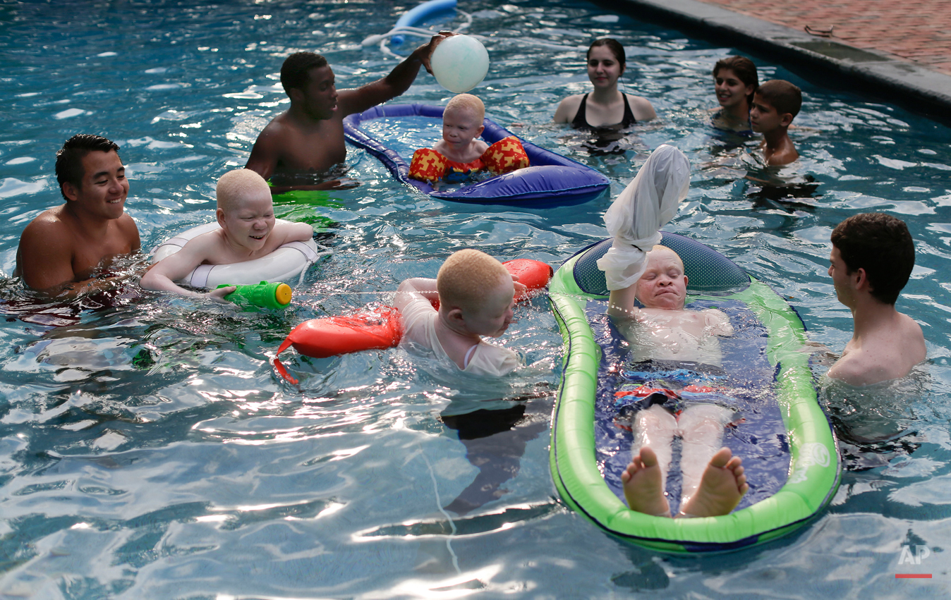  With the help of volunteer life guards, Mwigulu Magesa, Baraka Lusambo, Emmanuel Rutema and Pendo Noni swim and play in a pool in Oyster Bay, N.Y. on Monday, July 20, 2015. People with the genetic condition of albinism, characterized by a lack of pi
