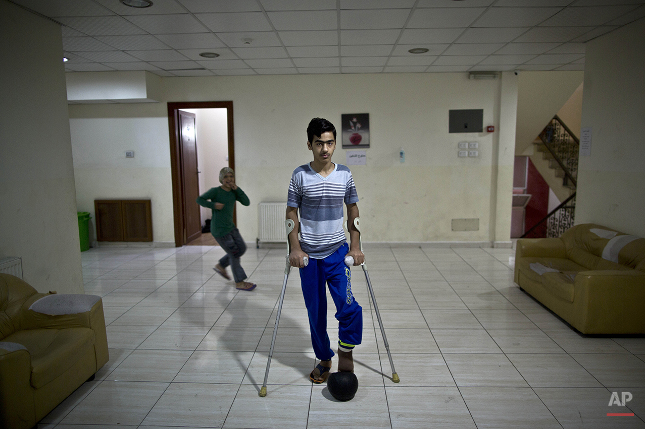  In this Monday, Aug. 24, 2015 photo, Iraqi Saif Mosa'ed, 15, who was injured in 2008 by a car bomb, poses for a picture at a hotel where he stays along with other patients of MSF Hospital for Specialized Reconstructive Surgery, run by the internatio