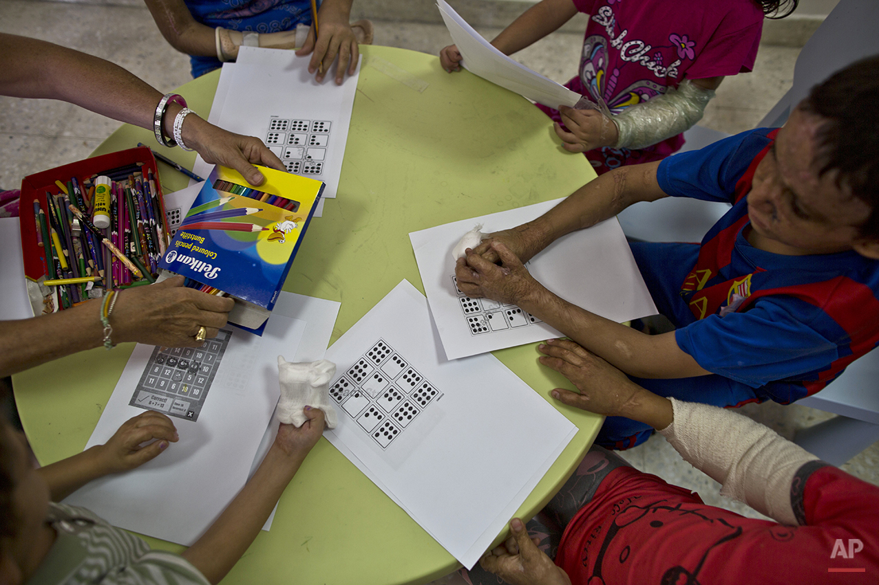  In this Monday, Aug. 17, 2015 photo, patients attend an activity at MSF Hospital for Specialized Reconstructive Surgery, run by the international charity Médecins Sans Frontières (Doctors Without Borders) in Amman, Jordan. Hospital psychologist Bila