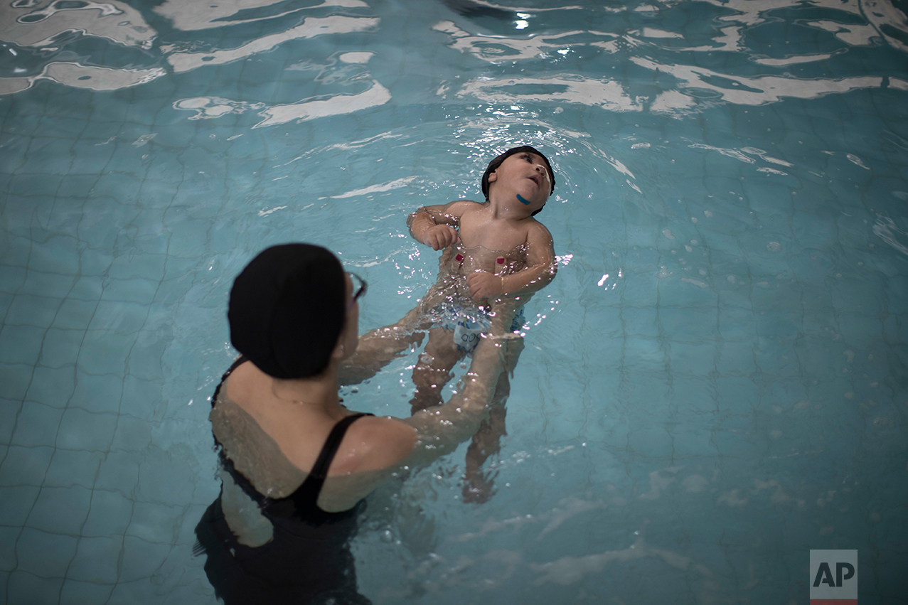 This Sept. 28, 2016 photo shows 1-year-old Arthur Conceicao, who was born with microcephaly, during his swimming pool physical therapy session at AACD rehabilitation center in Recife, Brazil. While scientists probe how Zika attacks fetuses in the womb, babies like Arthur born with brain damage caused by the virus are suffering numerous health problems such as trouble swallowing, worsening epileptic seizures and difficulty breathing. (AP Photo/Felipe Dana)