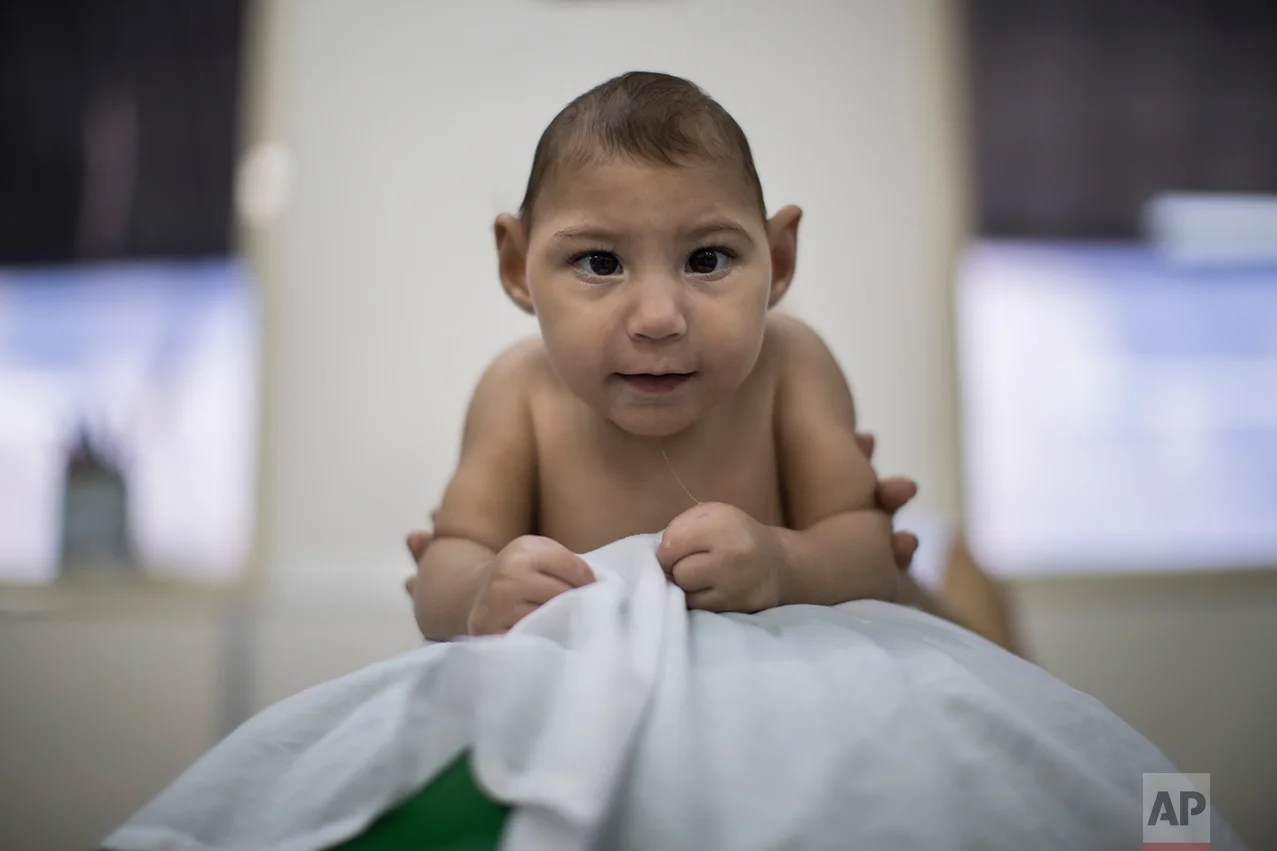 In this Sept. 28, 2016 photo, Helena Melo, who was born with microcephaly, balances on a ball during a physical therapy session at the AACD rehabilitation center in Recife, Brazil. Melo, 11 months old, travels more than two hours to Recife for therapy sessions three times a week. (AP Photo/Felipe Dana)