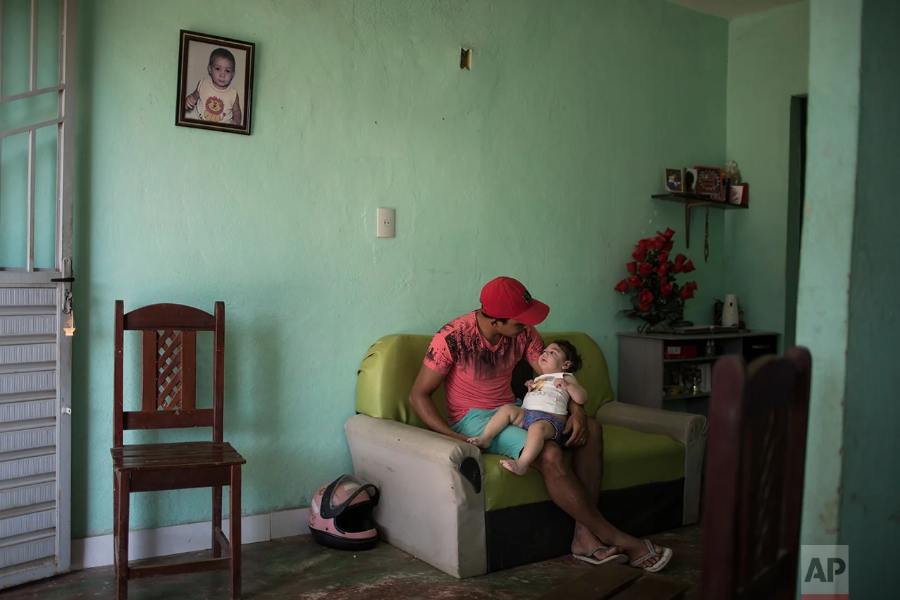 In this Sept. 26, 2016 photo, Dejailson Arruda holds his daughter Luiza, who was born with microcephaly when her mother was infected with the Zika virus, at their home in Santa Cruz do Capibaribe, Pernambuco state, Brazil. While more study is needed, swallowing difficulties, epileptic seizures and vision and hearing problems appear to be causing more severe problems in these infants than in patients born with small heads because of the other infections known to cause microcephaly, such as German measles and herpes. (AP Photo/Felipe Dana)
