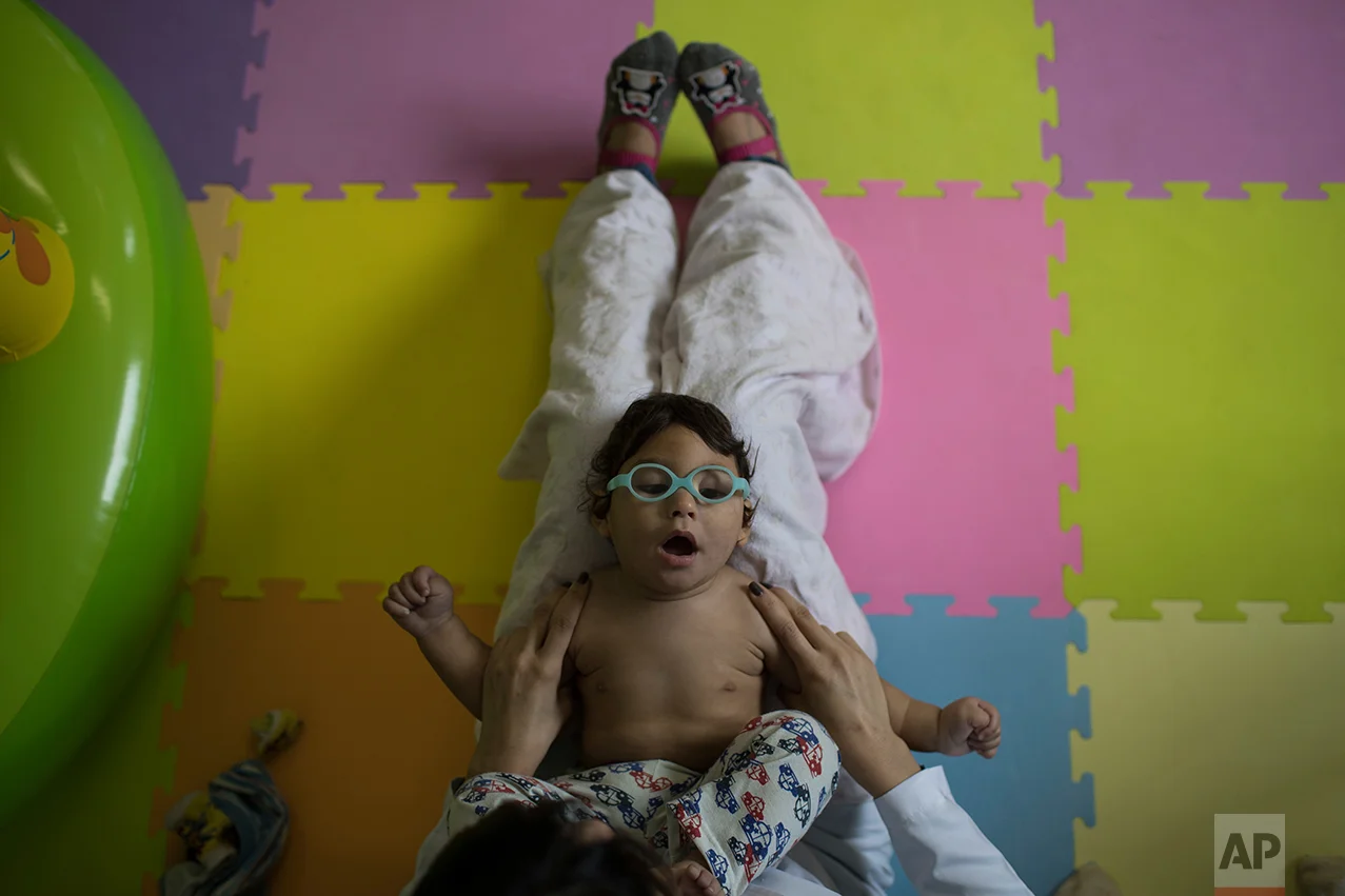 This Sept. 27, 2016 photo shows Lucas Matheus, who was born with microcephaly, during his physical therapy session at the UPAE hospital in Caruaru, Pernambuco state, Brazil. In Brazil, the government has reported 1,949 cases of microcephaly or other brain malformations in the last year. (AP Photo/Felipe Dana)