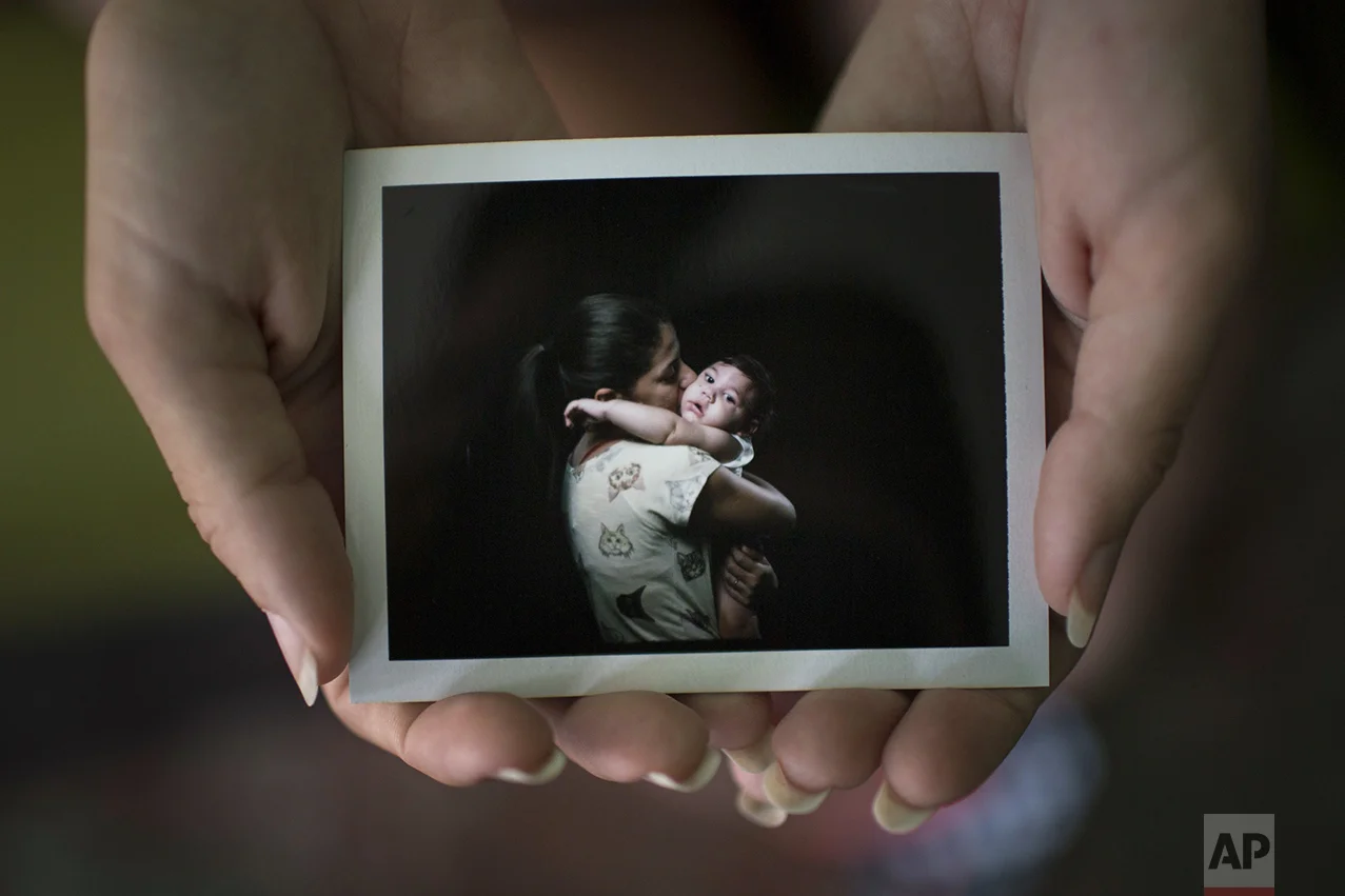 In this Sept. 26, 2016 photo, Angelica Pereira holds a instant film photo of her and her daughter Luiza, who was born with microcephaly, one of many serious medical problems that can be caused by congenital Zika syndrome, in Santa Cruz do Capibaribe, Pernambuco state, Brazil. For a brief moment, mothers with 1-year-old babies with microcephaly, forgot about getting that hard-to-find drug needed to prevent their babies from having seizures or the uncomfortable stares directed at their children born with small heads because of a Zika virus infection in the womb. Instead they were just like any other moms getting the first formal photographs of their babies. (AP Photo/Felipe Dana)