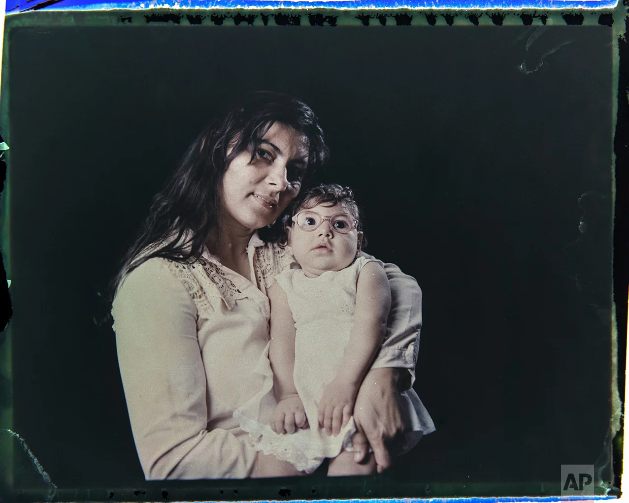 In this Sept. 29, 2016 photo made from a negative recovered from instant film, Jusikelly da Silva poses for a photo with her daughter Luhandra, who was born with microcephaly, one of many serious medical problems that can be caused by congenital Zika syndrome, in Recife, Pernambuco state, Brazil. Silva says she is desperate to get a brain scan for Luhandra, who was sitting up and eating solid foods before a seizure several months ago left her virtually motionless. (AP Photo/Felipe Dana)