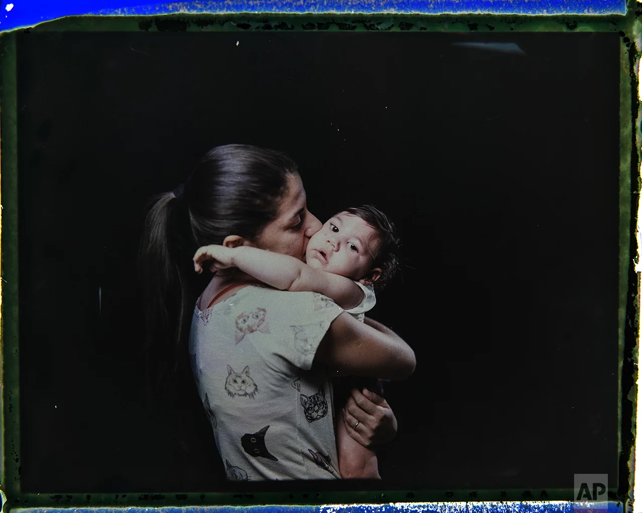 In this Sept. 26, 2016 photo made from a negative recovered from instant film, Angelica Pereira kisses her daughter Luiza, who was born with microcephaly, one of many serious medical problems that can be caused by congenital Zika syndrome, during a portrait session in Santa Cruz do Capibaribe, Pernambuco state, Brazil. "We are always chasing something. We have to drop everything else, all our chores, our homes," said the 21-year-old. "There are so many of us with children with special needs. (The government) is forgetting about that." (AP Photo/Felipe Dana)
