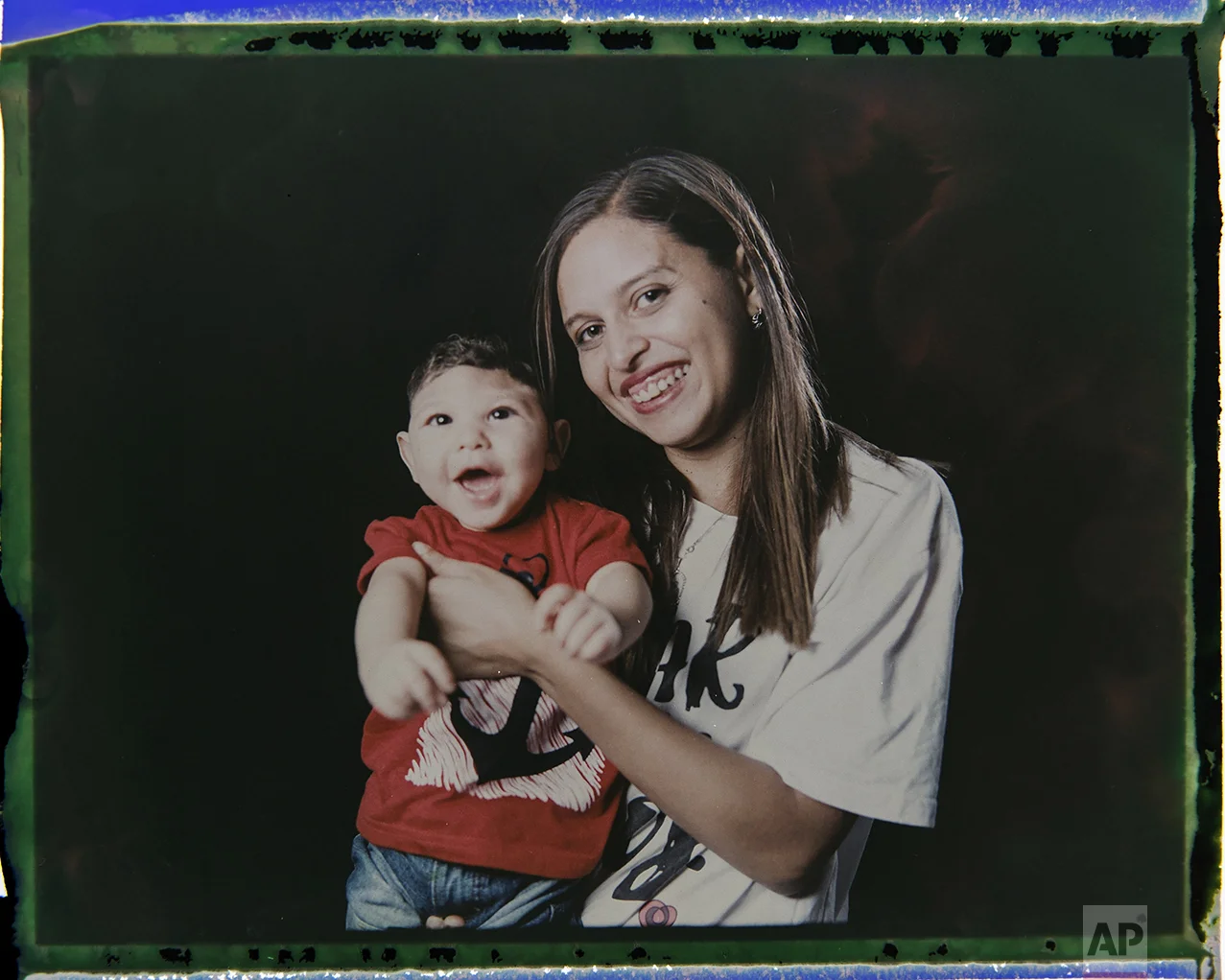 In this Sept. 29, 2016 photo made from a negative recovered from instant film, Daniele Ferreira dos Santos holds her son Juan Pedro, who was born with microcephaly, one of many serious medical problems that can be caused by congenital Zika syndrome, as they pose for a photo in Recife, Pernambuco state, Brazil. Santos is helped by her mother and older daughter, who often take turns caring for Juan Pedro. His father left the house a few weeks after he was born. (AP Photo/Felipe Dana)