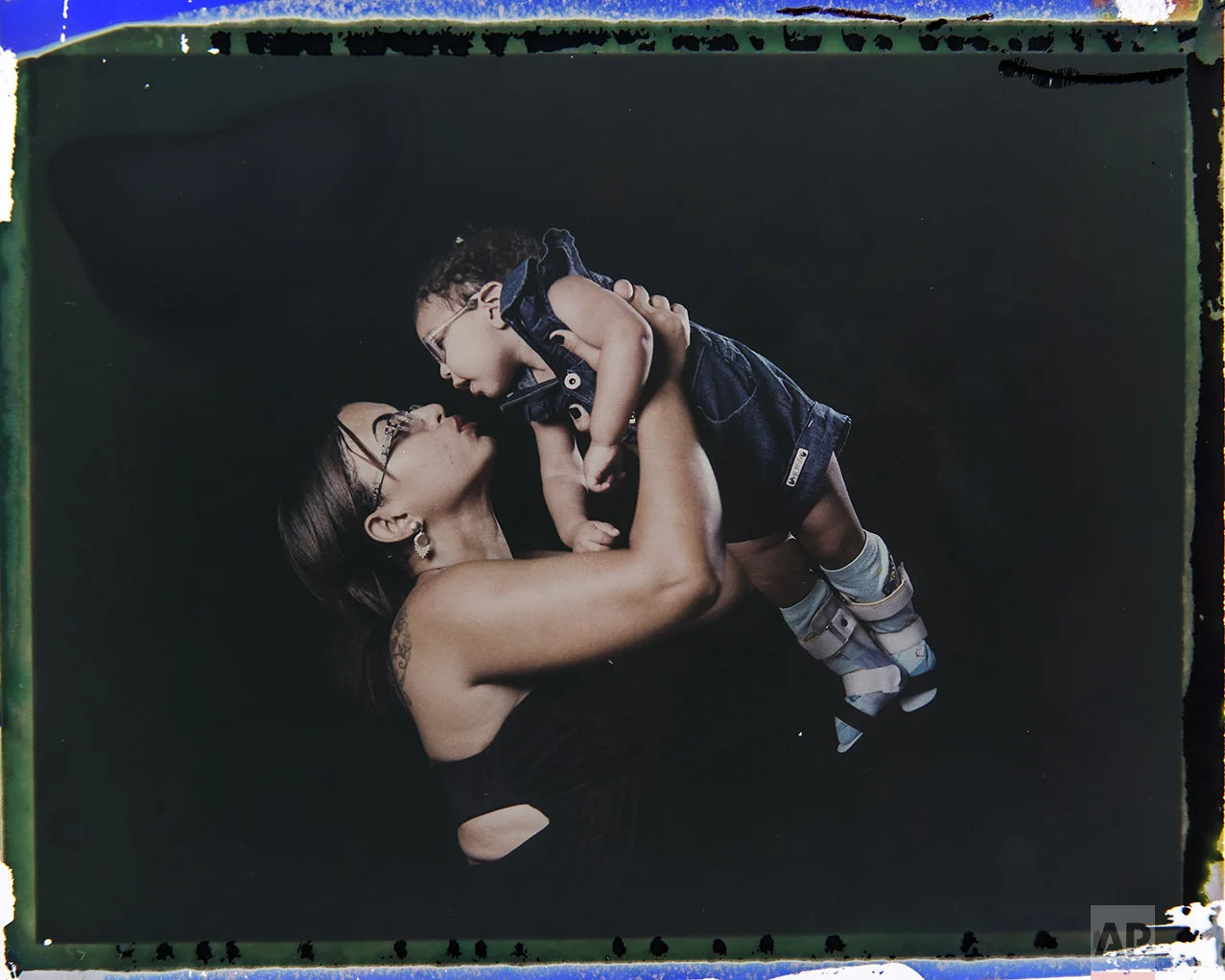 In this Sept. 29, 2016 photo made from a negative recovered from instant film, Rosana Alves holds her daughter Luana, who was born with microcephaly, one of many serious medical problems that can be caused by congenital Zika syndrome, as they pose for a photo in Recife, Pernambuco state, Brazil. Alves has three daughters and has left work to take care of Luana, who is equipped with specially designed leg braces to help position her feet. (AP Photo/Felipe Dana)