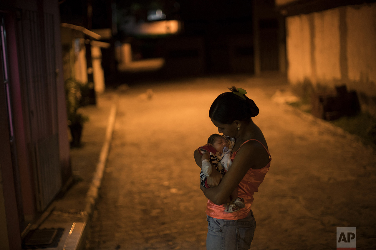  Daniele Ferreira dos Santos holds her son, Juan Pedro, who was born with microcephaly, outside her house in Recife, Pernambuco state, Brazil, on Jan. 26, 2016. Santos was never diagnosed with Zika, but she blames the virus for her son's defect and f