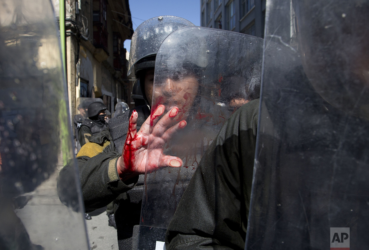  A police officer's hand is bloodied as he blocks protesters with disabilities from reaching Plaza Murillo, as they try to march to the National Palace where Bolivia's President Evo Morales has his offices, to demand an increase in government disabil