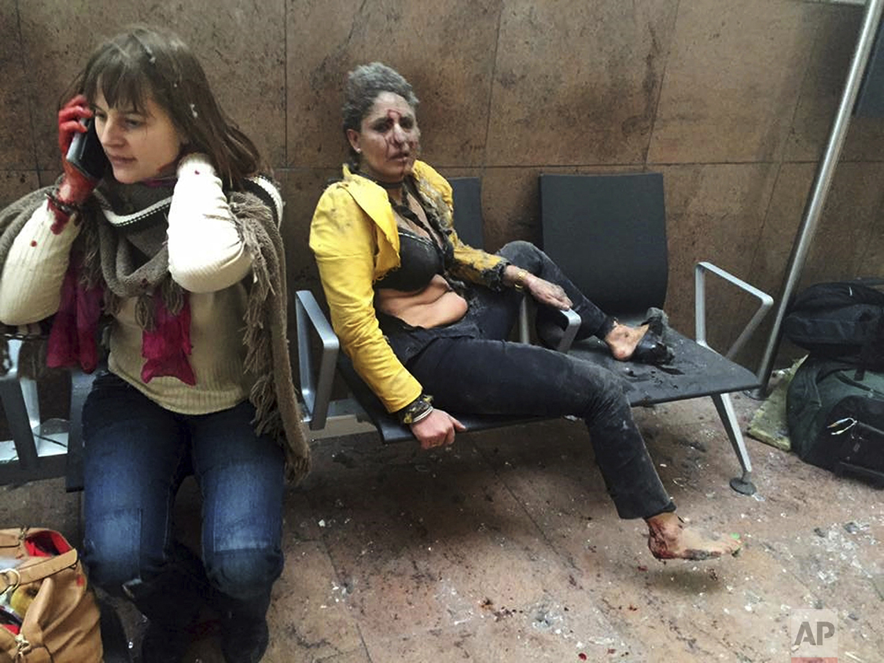  In this photo provided by Georgian Public Broadcaster and photographed by Ketevan Kardava, Nidhi Chaphekar, a 40-year-old Jet Airways flight attendant from Mumbai, right, and another unidentified woman are shown after being wounded in Brussels Airpo