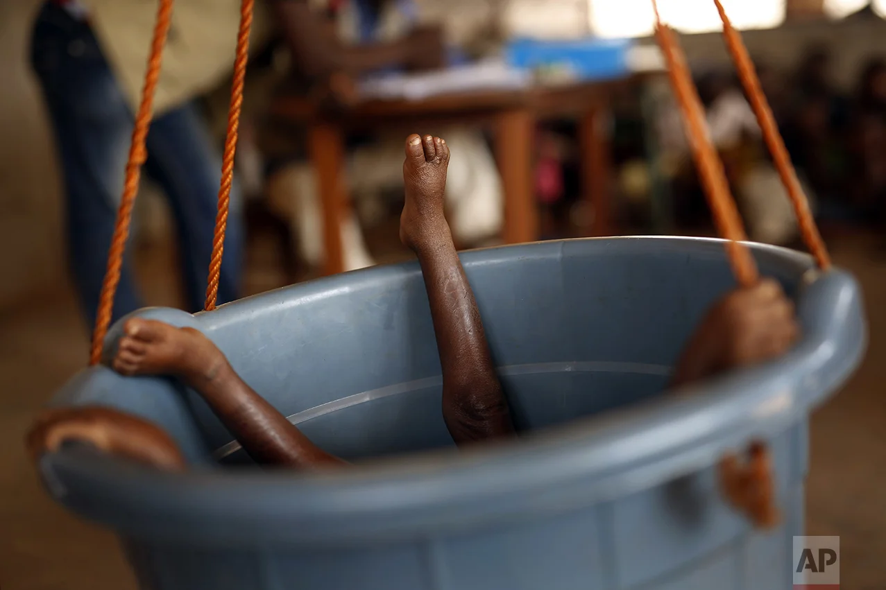 A young child lies in a bucket to be weighed by nurses in Bangui, Central African Republic, on Feb. 11, 2016. The United Nations World Food Program estimates that nearly half the country - 2.5 million people - are facing hunger as more than two years of violence have severely disrupted the country's agriculture and health care sectors. (AP Photo/Jerome Delay)