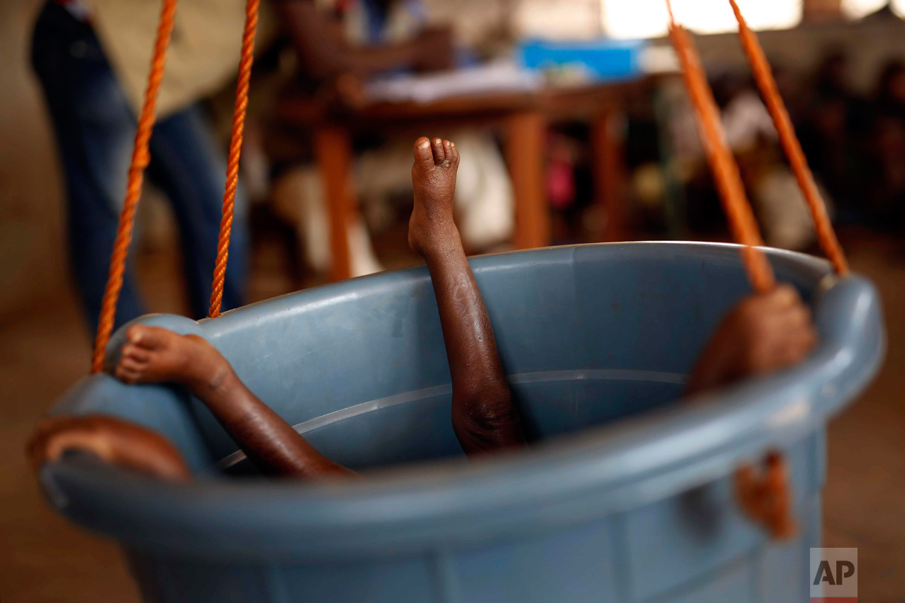  In this Thursday Feb. 11, 2016 photo, a young child lies in a bucket to be weighed by nurses in Bangui, Central African Republic. The U.N. World Food Program estimates that nearly half the country - 2.5 million people - are facing hunger as more tha