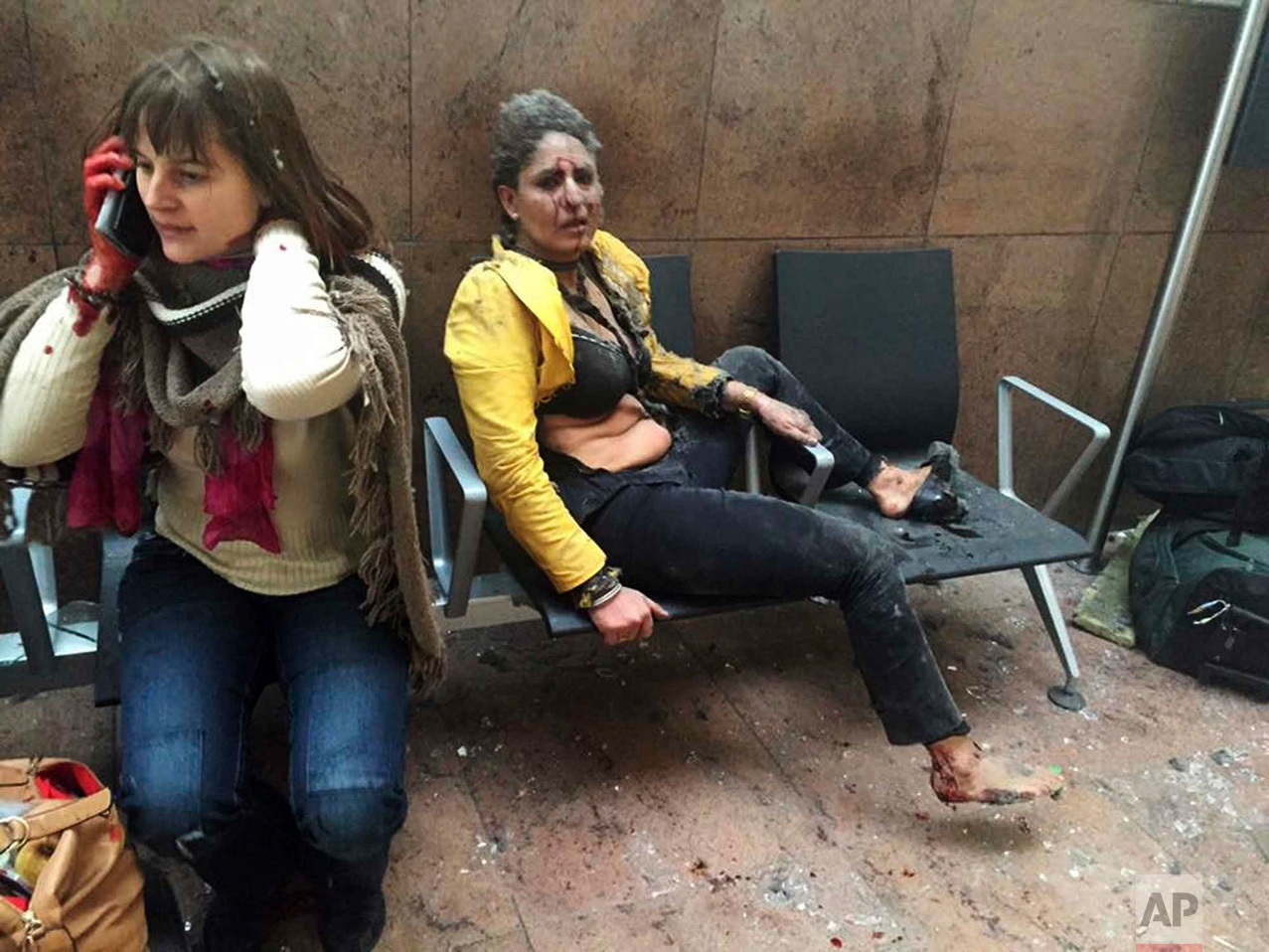  In this photo provided by Georgian Public Broadcaster and photographed by Ketevan Kardava, Nidhi Chaphekar, a 40-year-old Jet Airways flight attendant from Mumbai, right, and another unidentified woman are shown after being wounded in Brussels Airpo