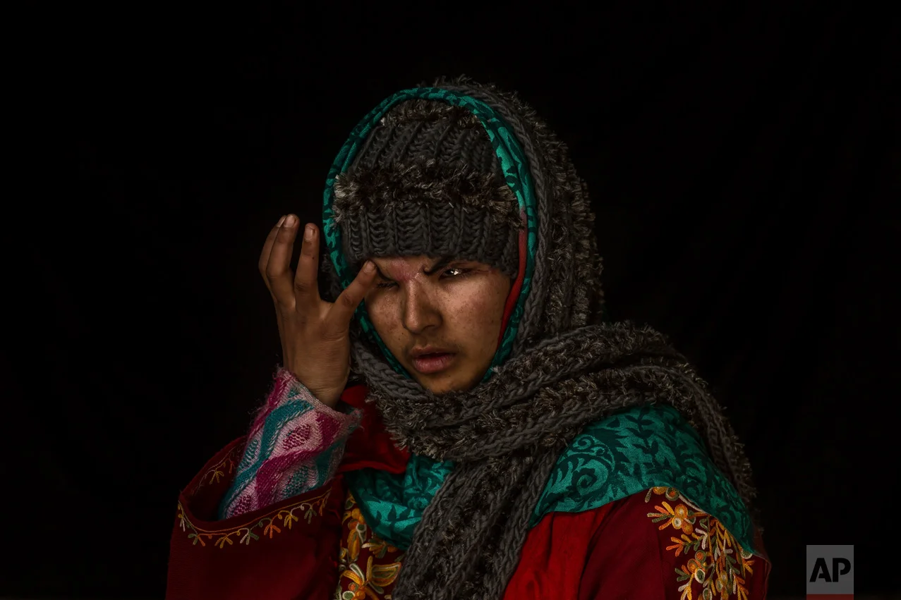In this Nov. 29, 2016 photo, Insha Mushtaq Malik poses for a portrait inside her home in Sedow, south Kashmir. Insha says she was standing by the window of her village home watching protesters and troops skirmish when more than 100 pellets hit her face, "Everything looks dark and black." Five months after she lost her eyes. Malik is still learning how to deal with her loss, both emotionally and practically. (AP Photo/Bernat Armangue)