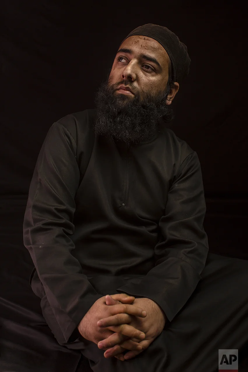 In this Nov. 30, 2016 photo, Aamir Kabir Beigh poses for a portrait in the village near Baramulla, Indian-controlled Kashmir. Kabir lost his vision six years ago because metal pellet injuries. Indian authorities began using shotguns for crowd control in Indian-controlled Kashmir in 2010, calling them “non-lethal” weapons that could control massive crowds of stone-throwing protests. International groups like Amnesty International and Human Rights Watch have called for an end to the use of shotguns. (AP Photo/Bernat Armangue)