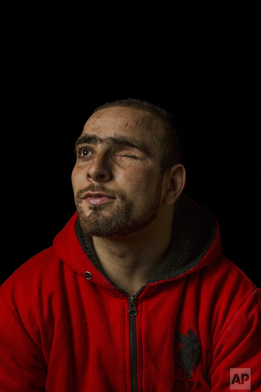 In this Dec. 1, 2016 photo, Danish Rajab Jhat, 24, poses for a portrait in Srinagar, Indian-controlled Kashmir. "My left eye is completely damaged and with my right eye I can only see some sort of shadows, not clear vision." Health officials say that in the past five months more than 6,000 people, mostly young men, have been injured by shotgun pellets, including hundreds blinded in one or both eyes. International groups like Amnesty International and Human Rights Watch have called for an end to the use of shotguns. (AP Photo/Bernat Armangue)