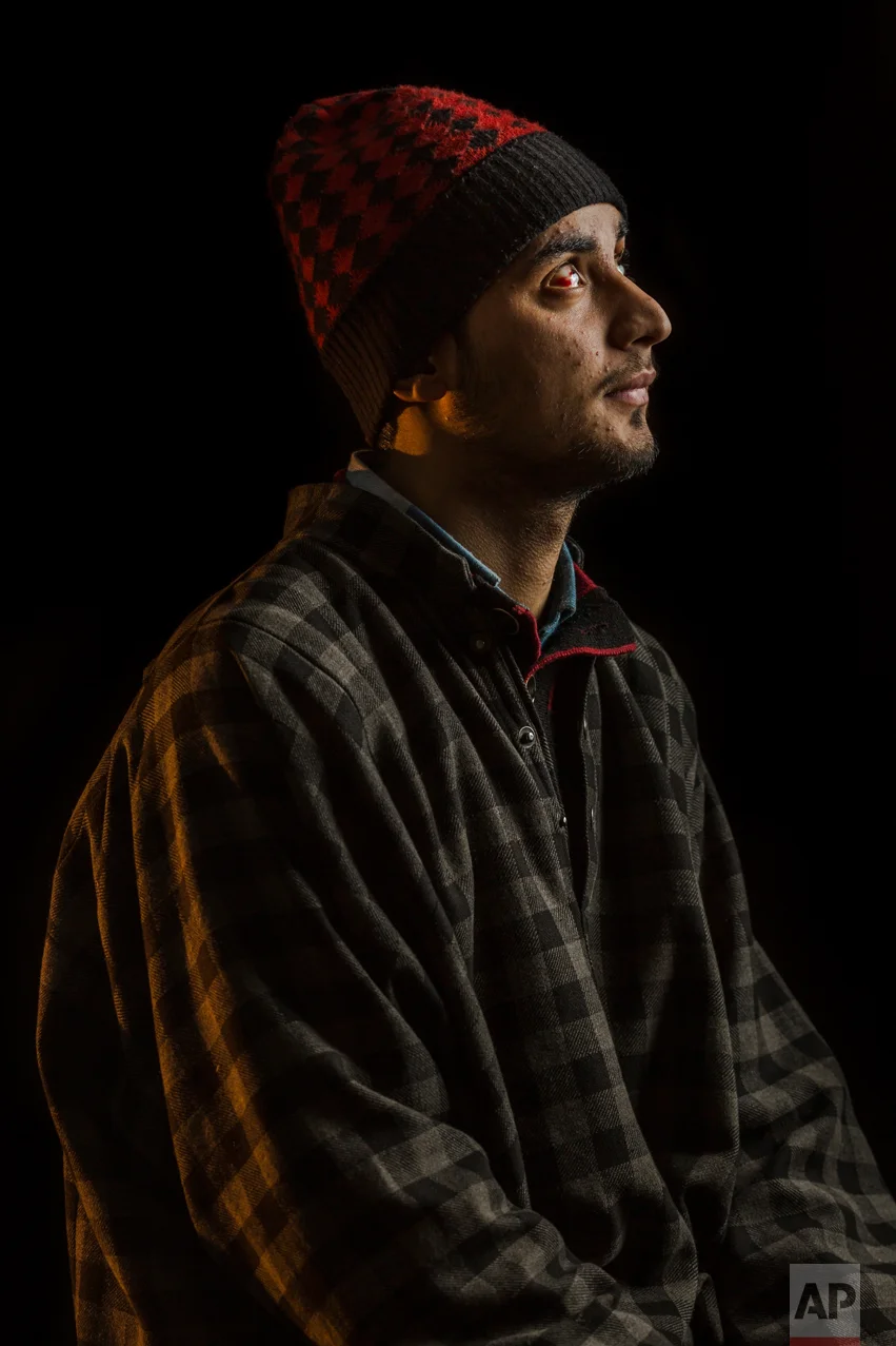 In this Dec. 2, 2016 photo, Javed Ah-Dar poses for a portrait in Rahmoo, district of Pulwama, Indian-controlled Kashmir. The most recent protests erupted in early July after Indian troops killed Burhan Wani, a young and charismatic militant commander and sparked off more than five months of angry street protests in the Kashmir valley. Javed was injured in both eyes by metal pellets when Indian forces raided the village. (AP Photo/Bernat Armangue)