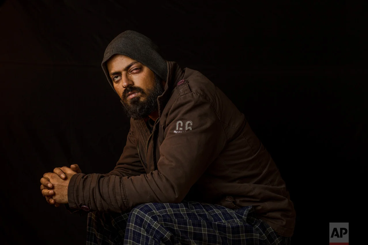 In this Dec. 1, 2016 photo, Photojournalist Xuhaib Maqbool, 30, poses for a portrait in Srinagar, Indian-controlled Kashmir. Xuhaib ended up losing vision in his left eye as he shot images of protesters chanting anti-India slogans and demanding "azadi" or freedom from Indian rule. He says he clearly raised his camera to show the soldier who shot at him that he was not a protester. (AP Photo/Bernat Armangue)