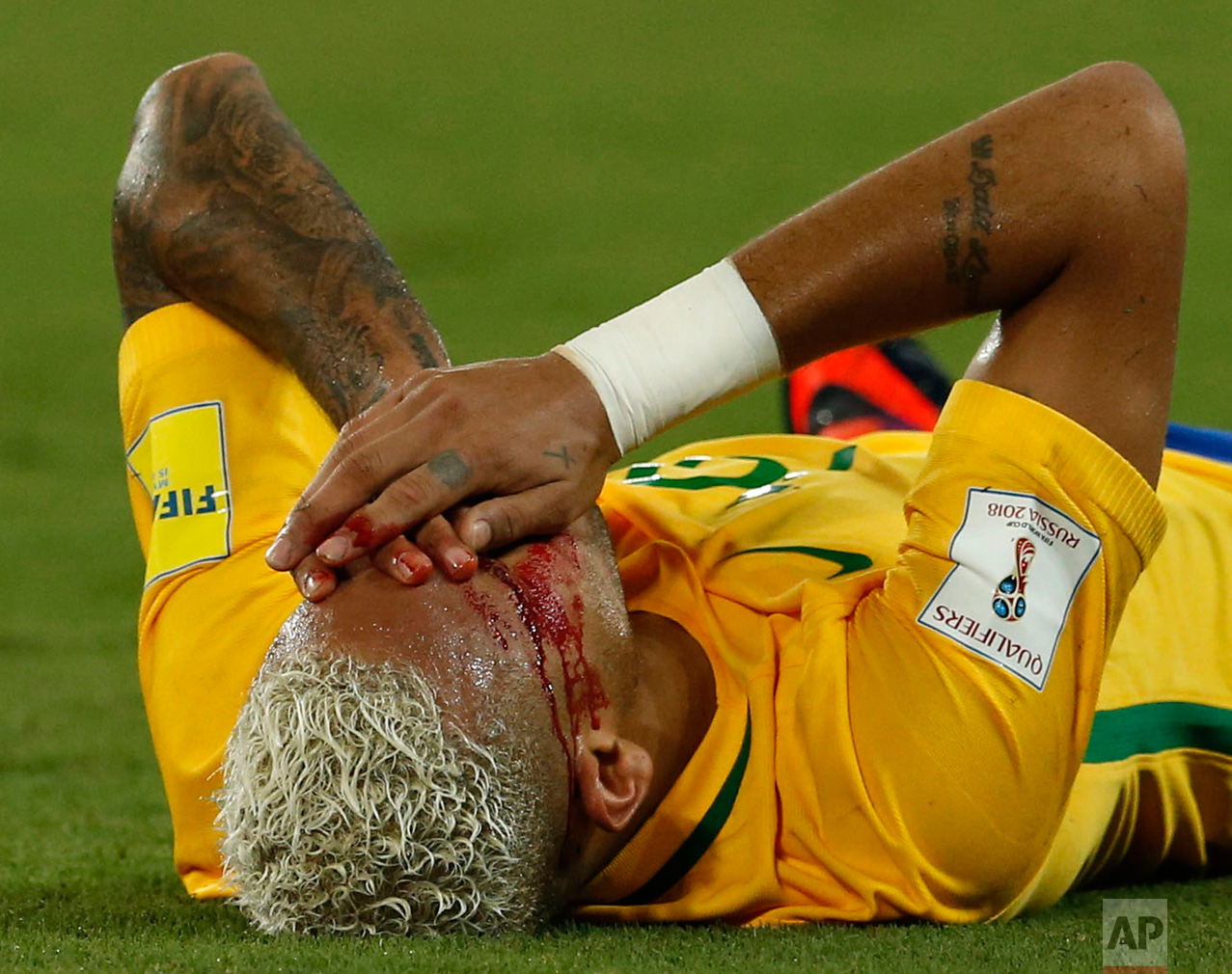  In this Thursday, Oct. 6, 2016 photo, Brazil's Neymar holds his bleeding face after a rough play during a 2018 World Cup qualifying soccer match against Bolivia in Natal, Brazil. Neymar sat on the bench the second half of the game. (AP Photo/Leo Cor