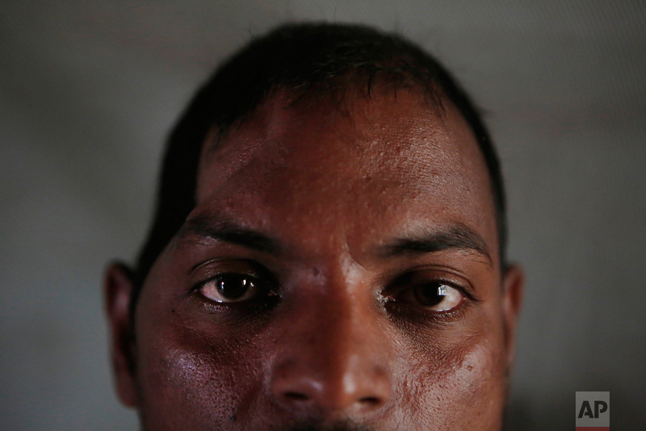 In this Nov. 24, 2016 photo, Salit Mandal, 28, sits on his bed at his home in Parikauli Village, Saptari district, a region where many men have left to work abroad as unskilled laborers, Nepal. Mandal, who rolled off a third-level bunk in Malaysia and smashed his skull, is in debt and partially paralyzed, and lives with his parents. His family had pinned their hopes on him after he returned from an earlier stint in Qatar with enough money to build a five-bedroom house. Now his mom takes a visitor aside and says the situation is horrible, Salit can't squat by himself over the pit toilet, she says, and she has to clean him up afterward. (AP Photo/Niranjan Shrestha)