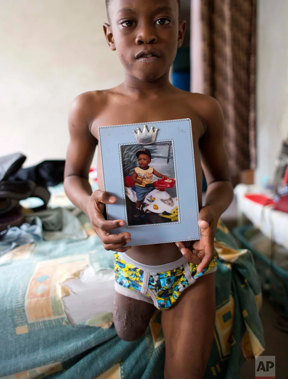 In this Jan. 8, 2017 photo, Judeley Hans Debel stands on his one leg, holding a portrait of himself when he was 1-year-old, at his home in Petion-Ville, Haiti. When Judeley was 2 ½, he was one of thousands of people to undergo amputations after the powerful earthquake that devastated Haiti's capital seven years ago. (AP Photo/Dieu Nalio Chery)