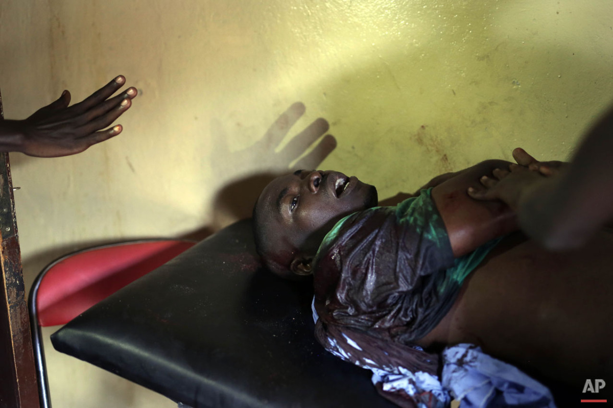  A demonstrator seriously wounded by live ammunition waits for treatment in a small clinic in the Musaga district of Bujumbura, Burundi, Monday May 4, 2015. (AP Photo/Jerome Delay) 