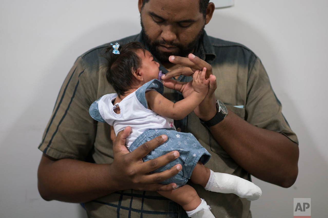  Laurinaldo Alves adjusts the pacifier of his daughter Luana Vitoria, who suffers from microcephaly, during a physical stimulation session at the Altino Ventura foundation, a treatment center that provides free health care, in Recife, Pernambuco stat