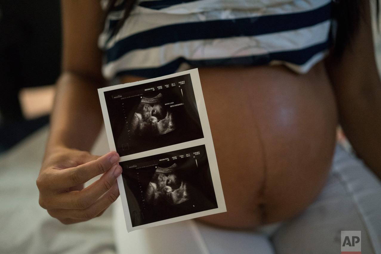  Isabela Cristina, 18, who is six months pregnant, shows a photo of her ultrasound at the IMIP hospital in Recife, Pernambuco state, Brazil, Wednesday, Feb. 3, 2016. Isabela Cristina was struck with Zika and was worried about the health of her bay, b