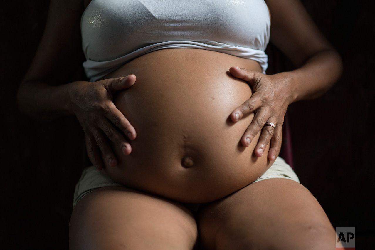  In this Feb. 5, 2016 photo, Daniele da Silva, who is seven months pregnant, poses for a photo as she sits inside her home in a slum of Recife, Brazil. Da Silva said she had Chikungunya a couple of months ago and her ultrasound scan and other exams o