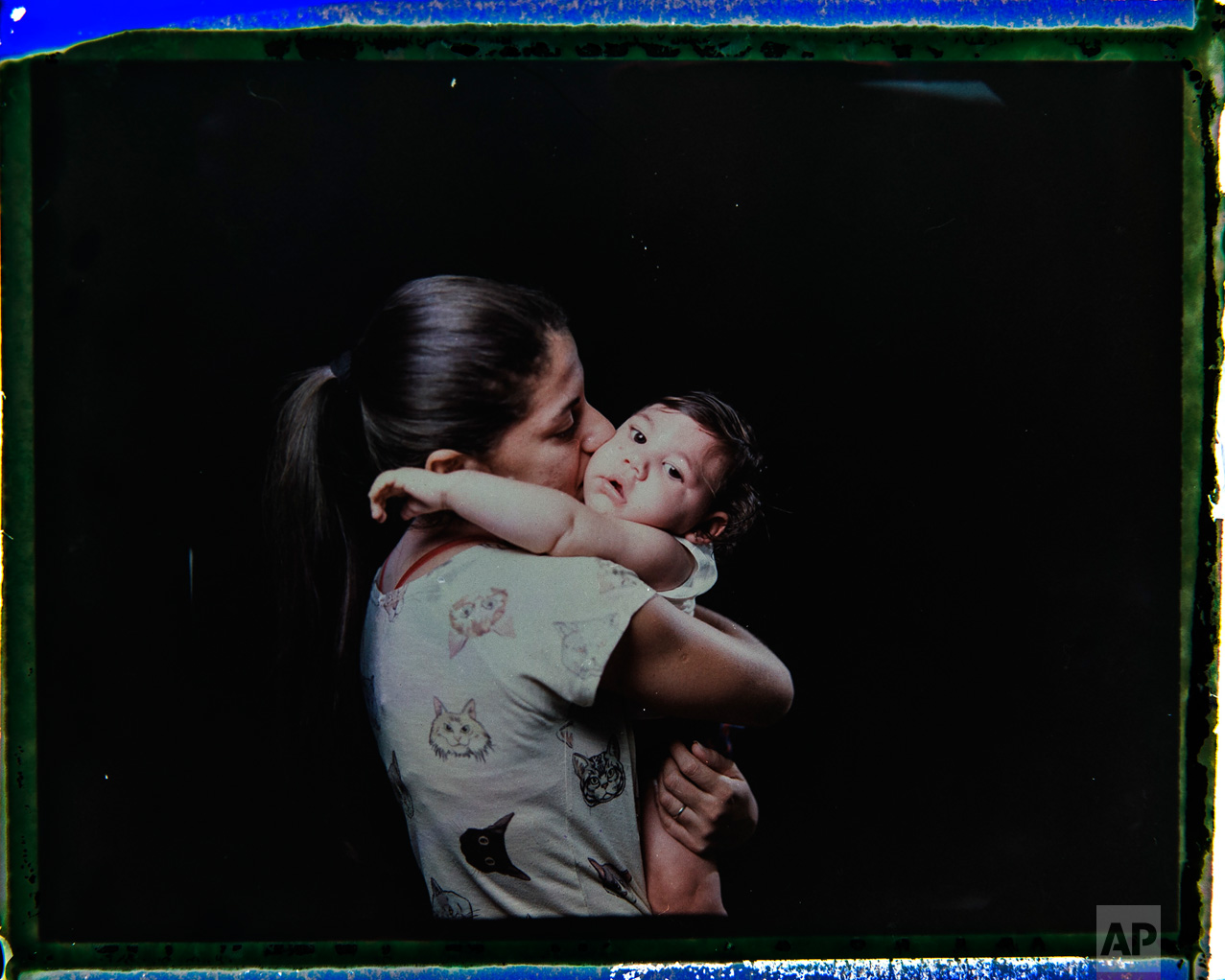  In this Sept. 26, 2016 photo made from a negative recovered from instant film, Angelica Pereira kisses her daughter Luiza, who was born with microcephaly, one of many serious medical problems that can be caused by congenital Zika syndrome, during a 